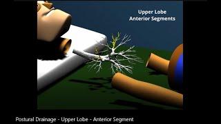 Postural Drainage: Upper Lobe - Anterior Segment