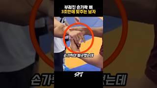 부러진 손가락 뼈 맞추는 남자 ㄷㄷ