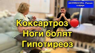 Коксартроз  Ноги Болят. Тазобедренные. Гипотиреоз «АКУПРЕССУРА - Россия» в эфире #шея  #акупрессура