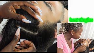 ASMR ATTENTIVE Scalp Inspection for people who need DEEP SLEEP