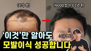 대부분이 잘 모르는 모발이식 200% 성공하는 5가지 조건! (현직 의사 추천)