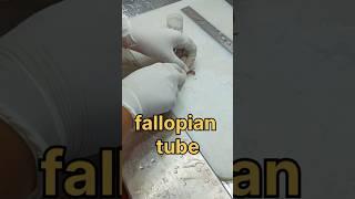 Fallopian tube biopsy sample| #histopathology #histomuseum #fallopiantubes #fallopiantubeblockage