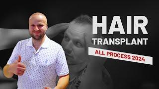 #hairtransplant  - Best Hair Transplant Istanbul