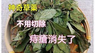 神奇草藥！快速消腫止痛，痔瘡消失了，不再復發！不用手術，親身經歷！