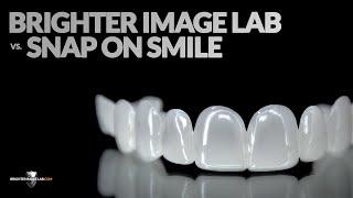 Snap-On Smile Cost vs Brighter Image Lab Veneers! We'll Beat their Cosmetic Dentist's Price by 50%!