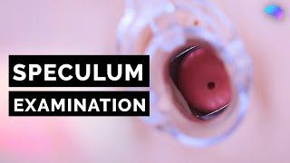 Speculum Examination | Vagina | OSCE Guide | UKMLA | CPSA