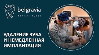  Удаление зуба и немедленная имплантация в Belgravia dental studio