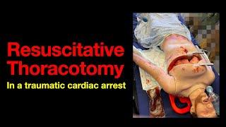 Resuscitative thoracotomy Simulation exercise at OSEM 23