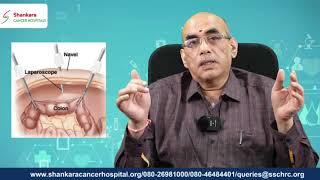 Robotic Surgery for Anterior Resection | Dr. Manjunath Sastry, Shankara Cancer Hospitals | Bengaluru