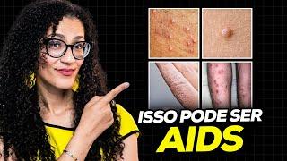 AIDS - Quando Suspeitar Da AIDS