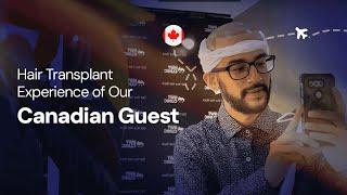 Hair Transplant Experience of Our Canadian Guest