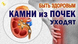 КАМНИ из почек УХОДЯТ!!! Помогают МИКРОСФЕРЫ ️️️