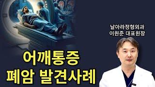 어깨통증 원인 폐암 발견사례