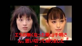 【エラ削り】栗山千明の整形ビフォーアフター画像【目頭切開　二重整形】