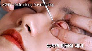 ASMR (SUB) Special Eye Cleaning Remove foreign substances from eye bubbles.