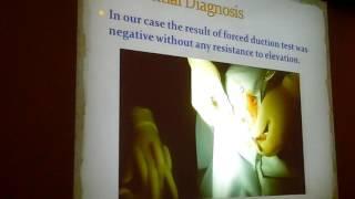 Monocular elevation deficit Dr Mohammed Ismaeil