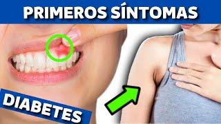 SÍNTOMAS INICIALES de DIABETES que no puedes IGNORAR