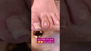 مامان ژیلا باشید نه مادر فولاد زره  ناخن توی گوشت داشتی من درخدمتم 09923729278 #پدیکور