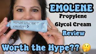 EMOLENE PROPLYLENE GLYCOL CREAM REVIEW | WORTH THE HYPE??