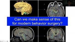 Future Neurosurgery at the Genetic Level. Next Steps to Solve Neurologic and Psychiatric Diseases