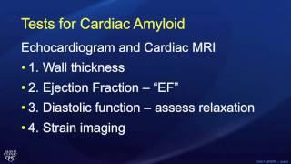 Cardiac Amyloidosis - Tests and Assessment