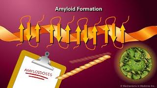 Amyloidosis