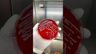 How bacteria are seen in the laboratory #chemistry #bacteria #medical #creative