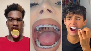 All Your TikTok Dental Pain In One Video!