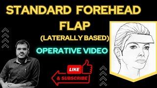 STANDARD FOREHEAD FLAP | HEAD AND NECK RECONSTRUCTION