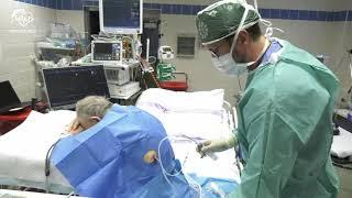 Pleural puncture (Thoracocentesis)
