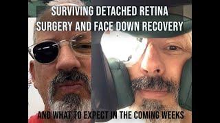 Detached Retina Surviving the Face Down Recovery and coming weeks.