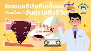 Happy Health by BDMS โรคแบคทีเรียกินเนื้อคน โรคเนื้อเน่า อันตรายถึงชีวิต