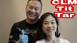 Master Chris Leong Tit Tar 跌打 Special Tit Tar Treatment for Neck