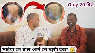 Hair Transplant In Raipur Chhattisgarh | Raipur CG Best FUE Hair Transplant Results Before And After