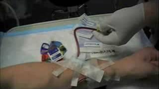 Dialysis Part I