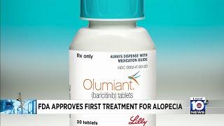 FDA approves treatment for alopecia