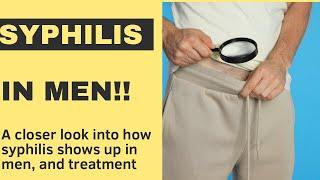 Syphilis in men,signs and symptoms and treatment options. #health #syphilis #drmutunga #doctor #stds