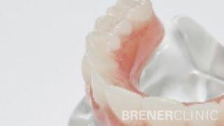 Brener Clinic - All-on-4 Dental Implants