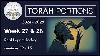 Torah Portion Week 27 & 28 - Leviticus 12 - 15 (Lepers In The Assembly Today)  2024 - 2025