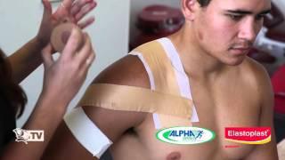 Shoulder Strapping Video