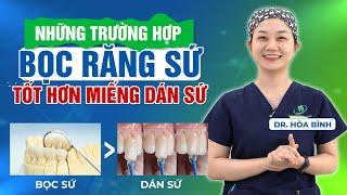 TRƯỜNG HỢP NÀO NÊN CHỌN RĂNG SỨ THAY VÌ DÁN SỨ VENEER?