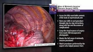 Atlas of Minimally Invasive Thoracic Surgery (VATS)