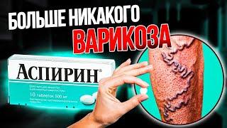 Хитрость бабушки по удалению варикозного расширения вен всего за неделю!