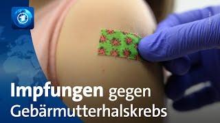 Rückgang bei Impfungen gegen Gebärmutterhalskrebs