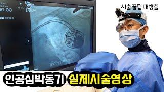 인공심박동기 I 실제시술영상 I 시술 꿀팁 대방출
