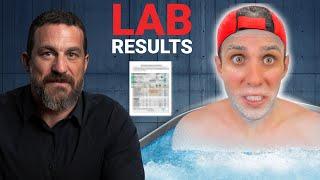 I Tried Dr Huberman's Ice-Bath Protocol (6 Week Results)