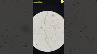 Condom Under Microscope | TULO - Microscope #shorts #underthemicroscope #condom