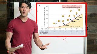 A New LDL-Cholesterol Theory Coming to a Doctor Near You