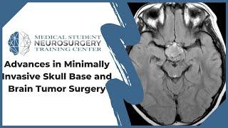 Advances in Minimally Invasive Skull Base and Brain Tumor Surgery