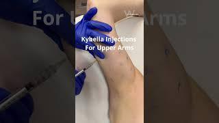 Get rid of underarm fat with Kybella injections!